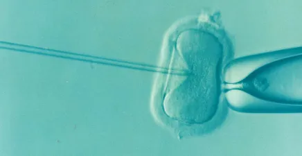 IVF